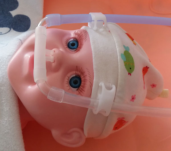 家用小兒CPAP呼吸機(jī)（氣管/喉軟骨軟化、氣道狹窄）